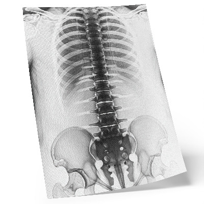Decoratieve poster Skelet in zwart-wit
